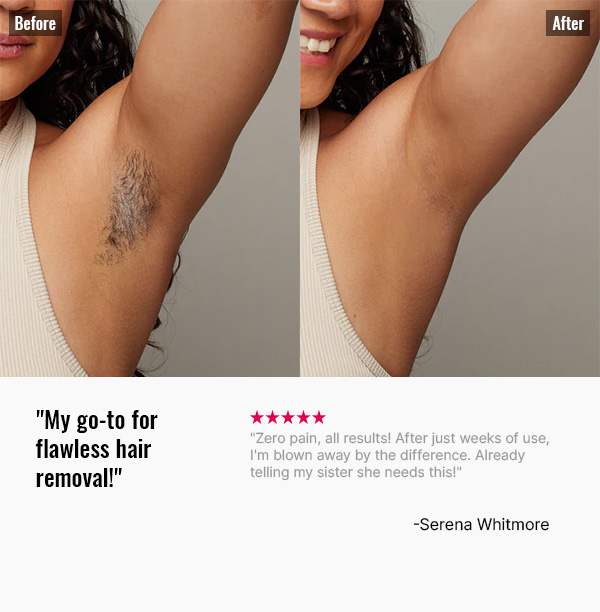 Before-After-1