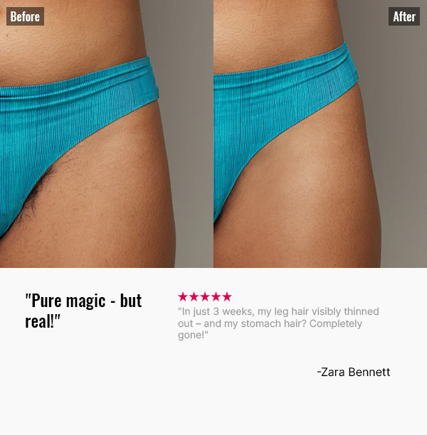 Before-After-2