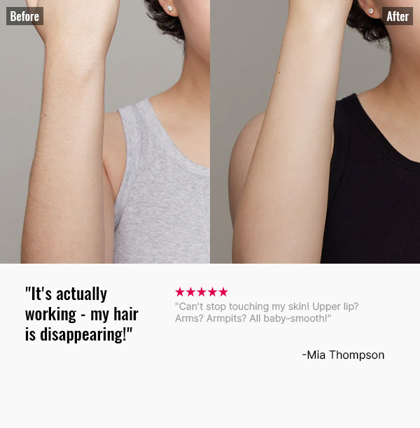 Before-After-3